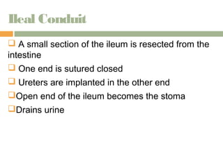 Ileal Conduit 
 A small section of the ileum is resected from the 
intestine 
 One end is sutured closed 
 Ureters are implanted in the other end 
Open end of the ileum becomes the stoma 
Drains urine 
 