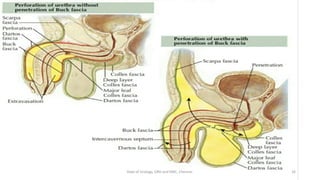 16
Dept of Urology, GRH and KMC, Chennai.
 