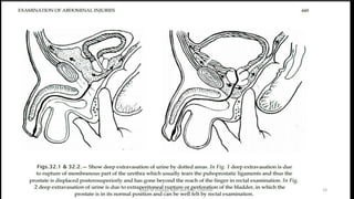 19
Dept of Urology, GRH and KMC, Chennai.
 
