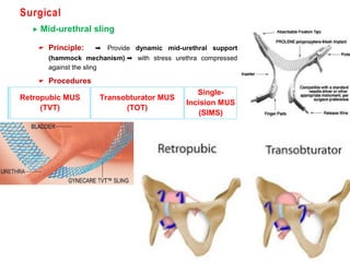 Single Incision Mus Female Urinary Incontinence , Dr. Ahmed Walid Anwar Morad ; Benha ...