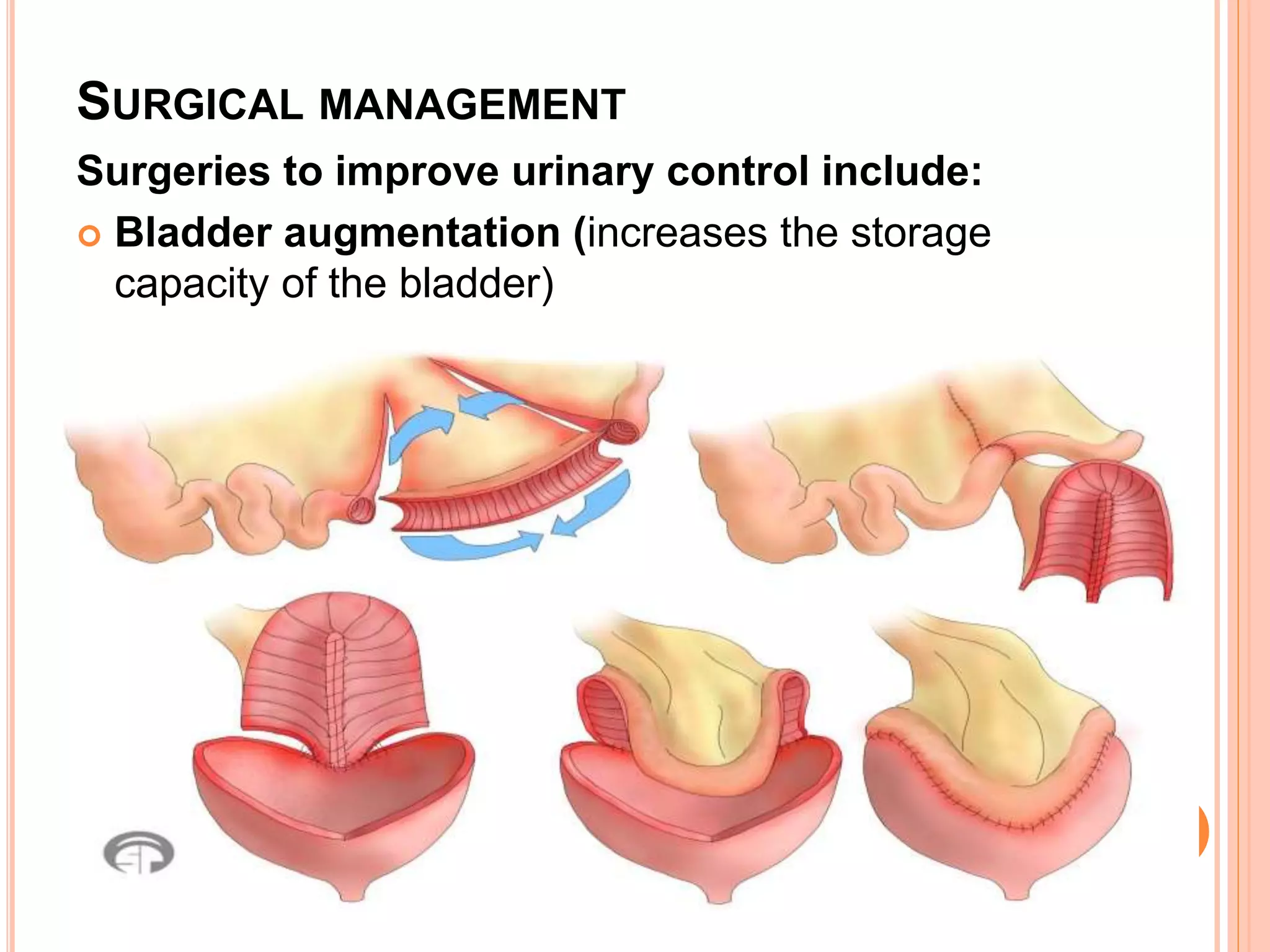 Positional Incontinance Urinary incontinance & retention of urine , nursing care | PPTX
