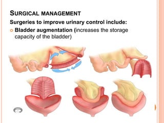 Urinary incontinance & retention of urine , nursing care | PPTX