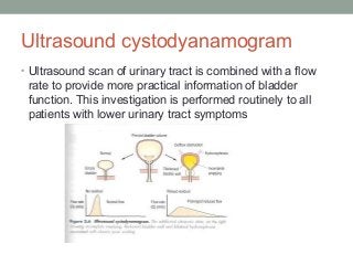 Ultrasound cystodyanamogram
• Ultrasound scan of urinary tract is combined with a flow
rate to provide more practical information of bladder
function. This investigation is performed routinely to all
patients with lower urinary tract symptoms
 