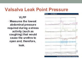 Valsalva Leak Point Pressure
VLPP
• Measures the lowest
abdominal pressure
required during a stress
activity (such as
coughing) that would
cause the urethra to
open and, therefore,
leak.
 