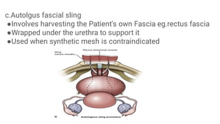 URINARY INCONTINENCE in Surgery for MBBS | PDF