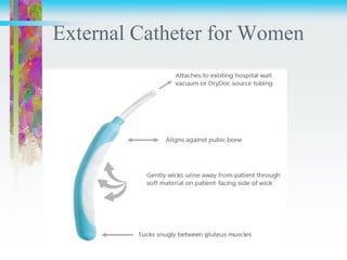 External Catheter for Women
 