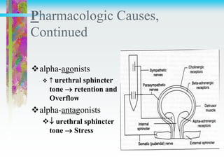 Pharmacologic Causes,
Continued
alpha-agonists
  urethral sphincter
tone  retention and
Overflow
alpha-antagonists
 urethral sphincter
tone  Stress
 