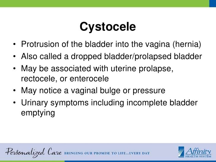 Stress Urinary Incontinence & Cytoceles