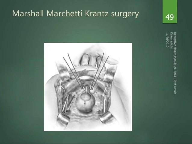 Urinary Incontinence in Females