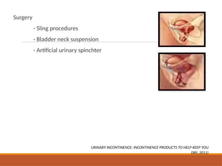 Urinary incontinence and its Treatment.pptx
