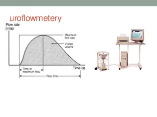 uroflowmetery
 