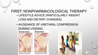 FIRST: NONPHARMACOLOGICAL THERAPY
• LIFESTYLE ADVICE (PARTICULARLY WEIGHT
LOSS AND DIETARY CHANGES).
• AVOIDANCE OF URETHRAL COMPRESSION
DURING VOIDING.
 