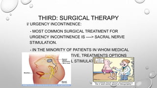 THIRD: SURGICAL THERAPY
I/ URGENCY INCONTINENCE:
- MOST COMMON SURGICAL TREATMENT FOR
URGENCY INCONTINENCE IS ----> SACRAL NERVE
STIMULATION.
- IN THE MINORITY OF PATIENTS IN WHOM MEDICAL
THERAPY IS INEFFECTIVE, TREATMENTS OPTIONS
INCLUDE: ELECTRICAL STIMULATION.
 