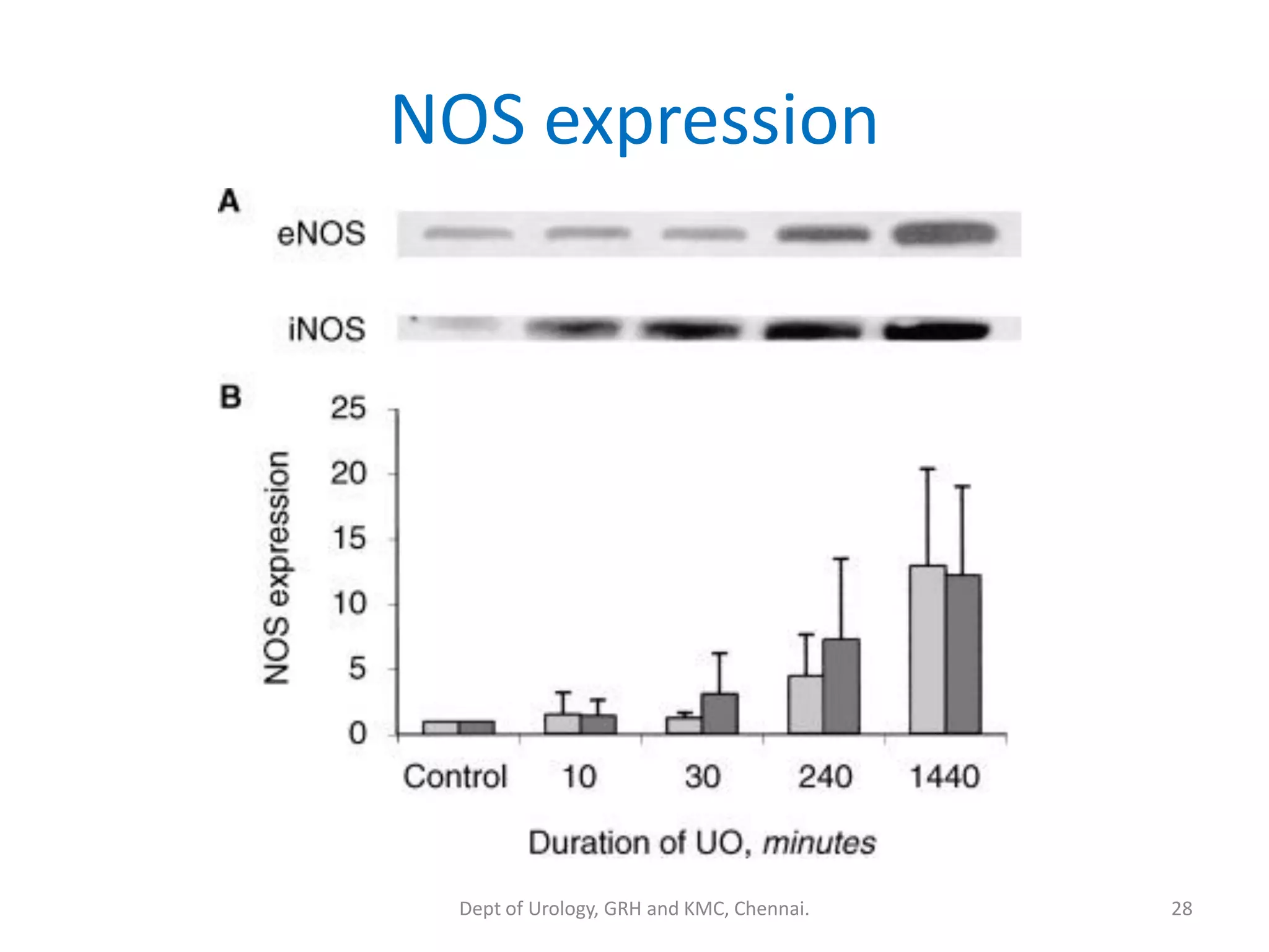 NOS expression
28
Dept of Urology, GRH and KMC, Chennai.
 