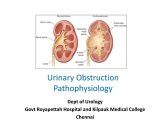 Urinary Obstruction
Pathophysiology
Dept of Urology
Govt Royapettah Hospital and Kilpauk Medical College
Chennai
 