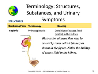 Copyright © 2014, 2011, 2007 by Saunders, an imprint of Elsevier Inc. 13
Terminology: Structures,
Substances, and Urinary
Symptoms
STRUCTURES
nephr/o hydronephrosis Condition of excess fluid
(water) in the kidney
Combining Form Terminology Meaning
Obstruction of urine flow may be
caused by renal calculi (stones) as
shown in the figure. Notice the buildup
of excess fluid in the kidney.
 
