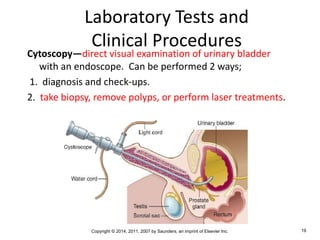 Copyright © 2014, 2011, 2007 by Saunders, an imprint of Elsevier Inc. 19
Laboratory Tests and
Clinical Procedures
Cytoscopy—direct visual examination of urinary bladder
with an endoscope. Can be performed 2 ways;
1. diagnosis and check-ups.
2. take biopsy, remove polyps, or perform laser treatments.
 