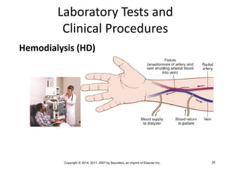 Copyright © 2014, 2011, 2007 by Saunders, an imprint of Elsevier Inc. 20
Laboratory Tests and
Clinical Procedures
Hemodialysis (HD)
 