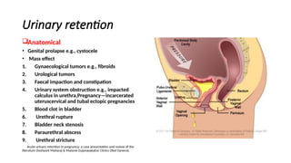 urinary retention urinary retention urinary retention | PPTX