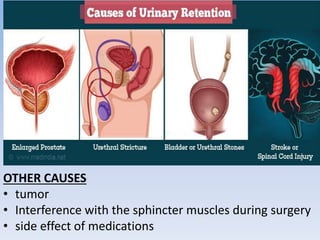 CAUSES OF RETENTION
OTHER CAUSES
• tumor
• Interference with the sphincter muscles during surgery
• side effect of medications
 