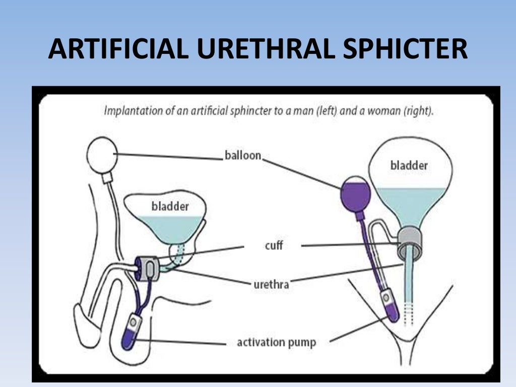 Urinary retention and incontinence