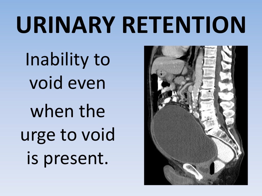 Urinary Retention And Incontinence urinary-retention-and-incontinence