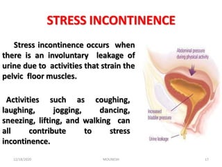 Urinary retention and incontinence | PPTX
