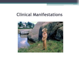 Clinical Manifestations
 