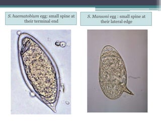 S. haematobium egg: small spine at
their terminal end
S. Mansoni egg : small spine at
their lateral edge
 