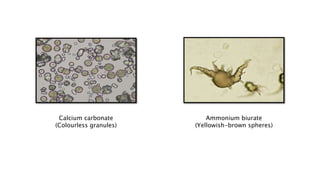 Calcium carbonate
(Colourless granules)
Ammonium biurate
(Yellowish-brown spheres)
 