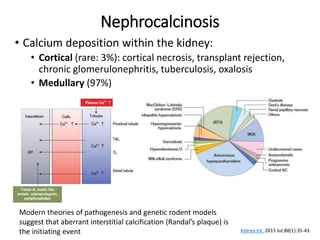 Nephrocalcinosis
• Calcium deposition within the kidney:
• Cortical (rare: 3%): cortical necrosis, transplant rejection,
chronic glomerulonephritis, tuberculosis, oxalosis
• Medullary (97%)
Kidney Int. 2015 Jul;88(1):35-43.
Modern theories of pathogenesis and genetic rodent models
suggest that aberrant interstitial calcification (Randal’s plaque) is
the initiating event
 