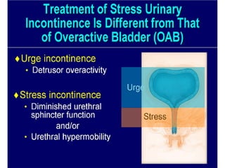 Urinary STRESS Incontinence Copy.pdf
