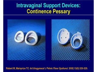 Urinary STRESS Incontinence Copy.pdf