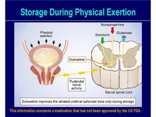 Urinary STRESS Incontinence Copy.pdf