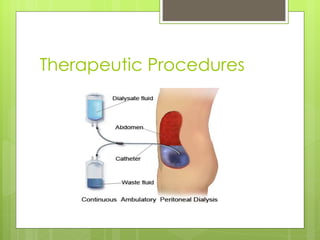 Therapeutic Procedures 