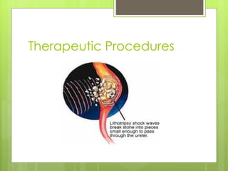 Therapeutic Procedures 