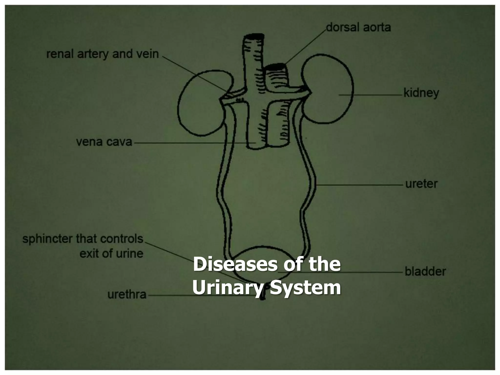 Diseases of the
Urinary System
 