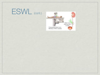 ESWL   (cont.)
 