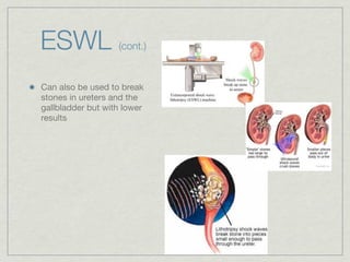 ESWL               (cont.)


Can also be used to break
stones in ureters and the
gallbladder but with lower
results
 