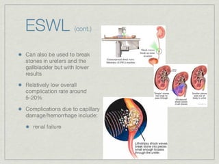 ESWL               (cont.)


Can also be used to break
stones in ureters and the
gallbladder but with lower
results

Relatively low overall
complication rate around
5-20%

Complications due to capillary
damage/hemorrhage include:

   renal failure
 