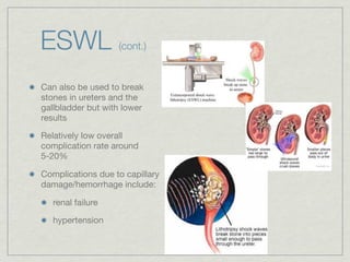 ESWL               (cont.)


Can also be used to break
stones in ureters and the
gallbladder but with lower
results

Relatively low overall
complication rate around
5-20%

Complications due to capillary
damage/hemorrhage include:

   renal failure

   hypertension
 