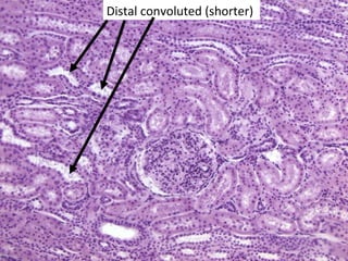 Distal convoluted (shorter)
 