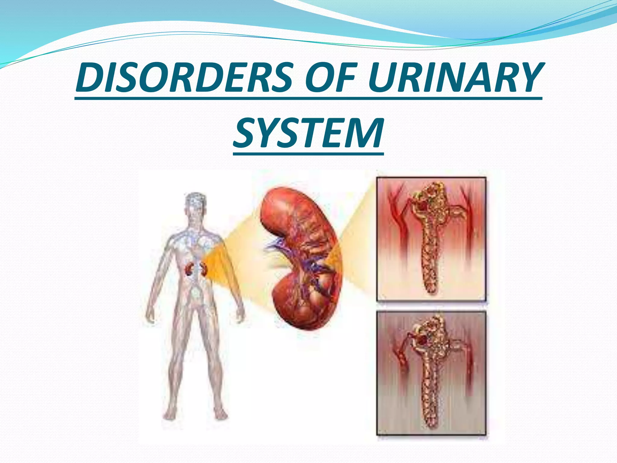 DISORDERS OF URINARY
SYSTEM
 