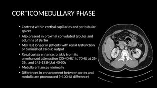 CORTICOMEDULLARY PHASE
• Contrast within cortical capillaries and peritubular
spaces
• Also present in proximal convoluted tubules and
columns of Bertin
• May last longer in patients with renal dysfunction
or diminished cardiac output
• Renal cortex enhances briskly from its
unenhanced attenuation (30-40HU) to 70HU at 25-
35s, and 145-185HU at 40-50s
• Medulla enhances minimally
• Differences in enhancement between cortex and
medulla are pronounced (~100HU difference)
 