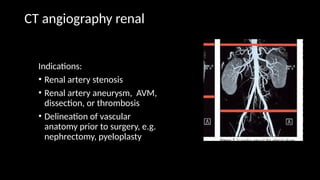 CT angiography renal
Indications:
• Renal artery stenosis
• Renal artery aneurysm, AVM,
dissection, or thrombosis
• Delineation of vascular
anatomy prior to surgery, e.g.
nephrectomy, pyeloplasty
 