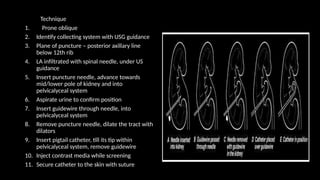 Technique
1. Prone oblique
2. Identify collecting system with USG guidance
3. Plane of puncture – posterior axillary line
below 12th rib
4. LA infiltrated with spinal needle, under US
guidance
5. Insert puncture needle, advance towards
mid/lower pole of kidney and into
pelvicalyceal system
6. Aspirate urine to confirm position
7. Insert guidewire through needle, into
pelvicalyceal system
8. Remove puncture needle, dilate the tract with
dilators
9. Insert pigtail catheter, till its tip within
pelvicalyceal system, remove guidewire
10. Inject contrast media while screening
11. Secure catheter to the skin with suture
 