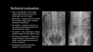 Technical evaluation
• Ensure visualization of the upper
poles of both kidneys even if the
diaphragm was not imaged
• Alignment – vertebral column should
be in midline. Ribs, pelvis, and hips
should be equidistant.
• No rotation – spinous processes in
the centre of vertebral column and
symmetrical iliac wings.
• No motion – ribs, diaphragm, and gas
bubble margins should appear sharp
• Soft tissue visualization – lower liver
margin, kidneys, lateral borders of
psoas, and transverse processes of
lumbar vertebrae
• Appropriate markers indication
upright or supine position
 
