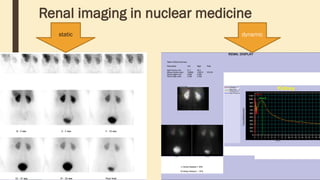 Renal imaging in nuclear medicine
static dynamic
 