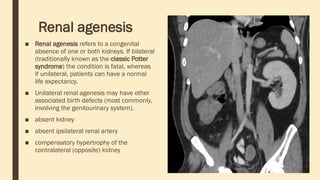 Renal agenesis
■ Renal agenesis refers to a congenital
absence of one or both kidneys. If bilateral
(traditionally known as the classic Potter
syndrome) the condition is fatal, whereas
if unilateral, patients can have a normal
life expectancy.
■ Unilateral renal agenesis may have other
associated birth defects (most commonly,
involving the genitourinary system).
■ absent kidney
■ absent ipsilateral renal artery
■ compensatory hypertrophy of the
contralateral (opposite) kidney
 