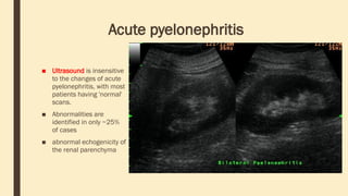 Acute pyelonephritis
■ Ultrasound is insensitive
to the changes of acute
pyelonephritis, with most
patients having 'normal'
scans.
■ Abnormalities are
identified in only ~25%
of cases
■ abnormal echogenicity of
the renal parenchyma
 
